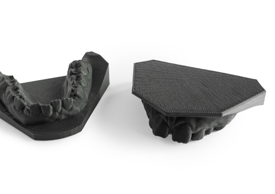 3D-gedruckte Kiefermodelle für die digitale Kieferorthopädie